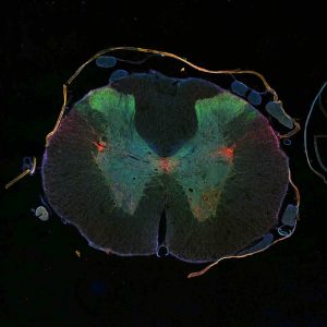 neuroregeneration ayahuasca